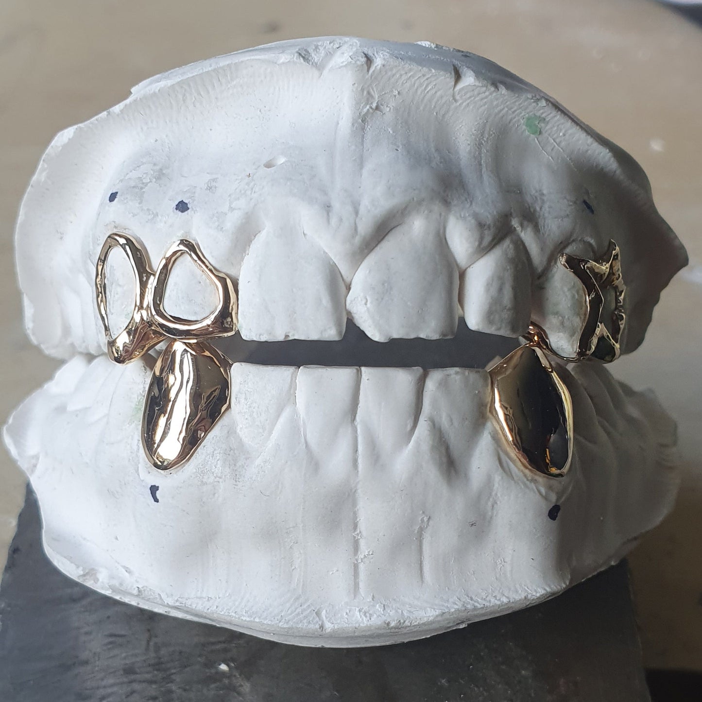 Polished Dental Caps