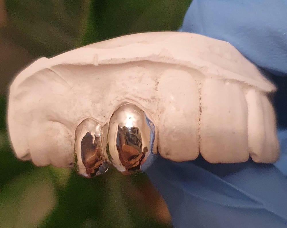 Polished Dental Caps